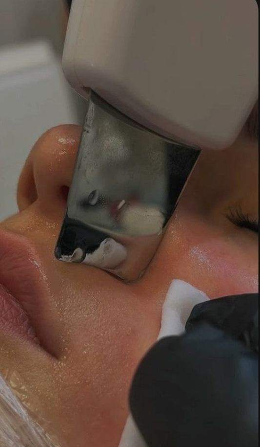 Espátula elétrica removedora de cravos e limpador a de poros - 3 modos - efeito lifting, efeito limpante e efeito hidratante