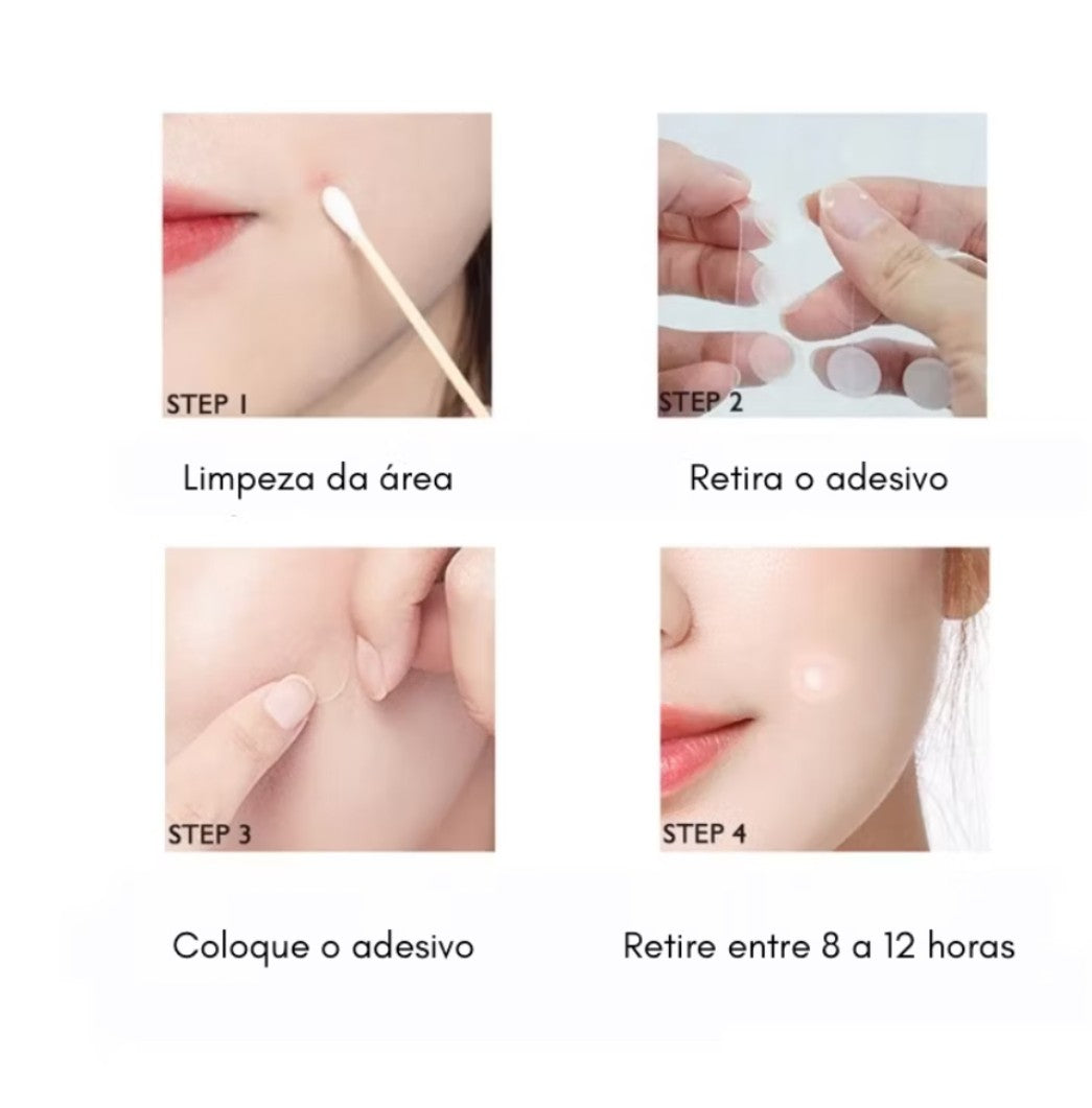 Adesivo hidrocoloide secador de espinhas